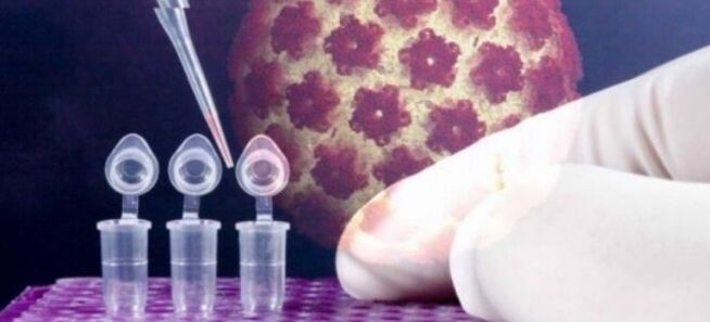 Diagnosis HPV dengan ujian Digene