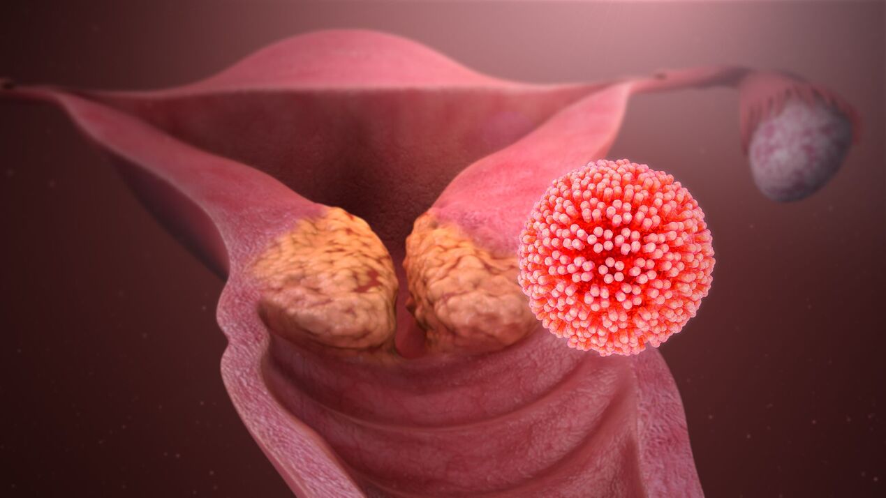 papillomavirus manusia dalam badan